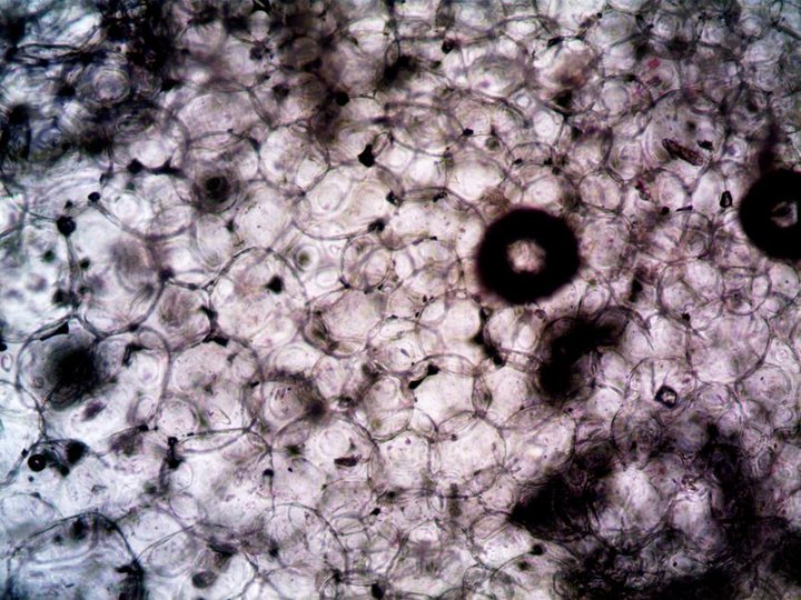 Brain Develops From Two Separate Progenitor Cells, Stanford Study Finds
